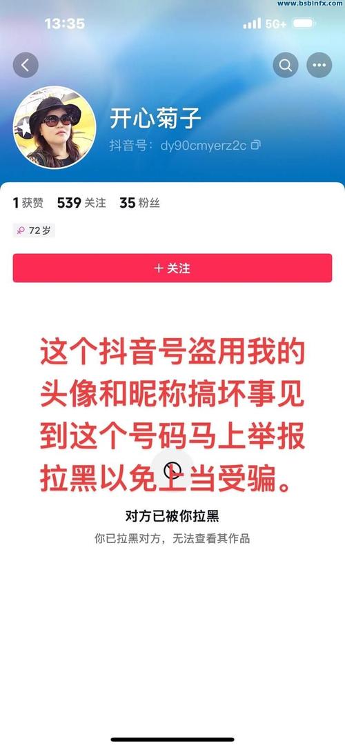 如何提高点赞数？抖音赞代刷 vs QQ空间自助平台 vs QQ支付