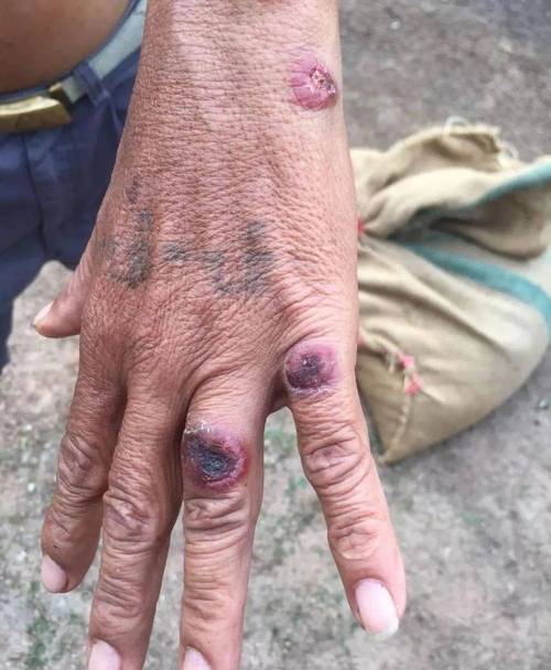 老挝新区疫情最新消息来了！