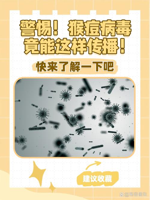 非典猴痘疫情最新消息—预防指南与行动指南