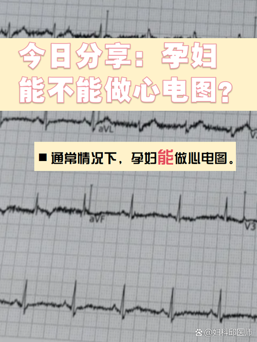 电脑对孕妇有辐射吗?如何正确使用电脑作为健康监测工具?