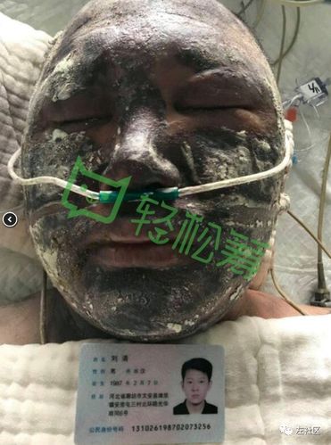 文安四村疫情最新动态解析