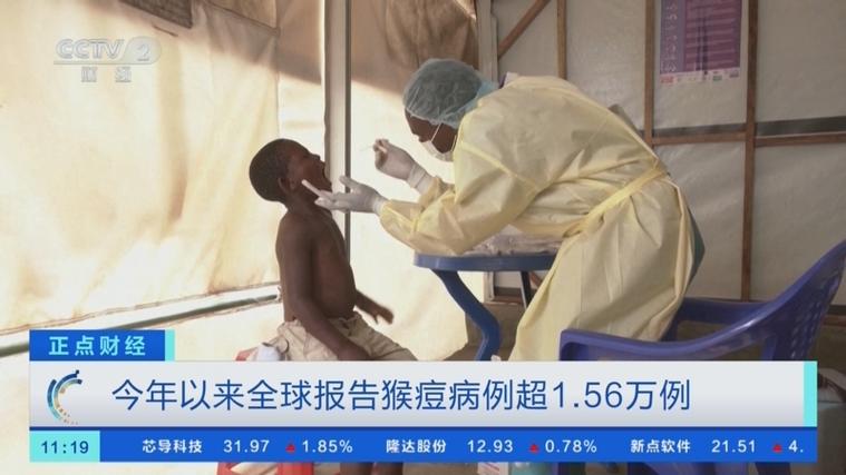 集宁疫情，一场全球性的公共卫生危机