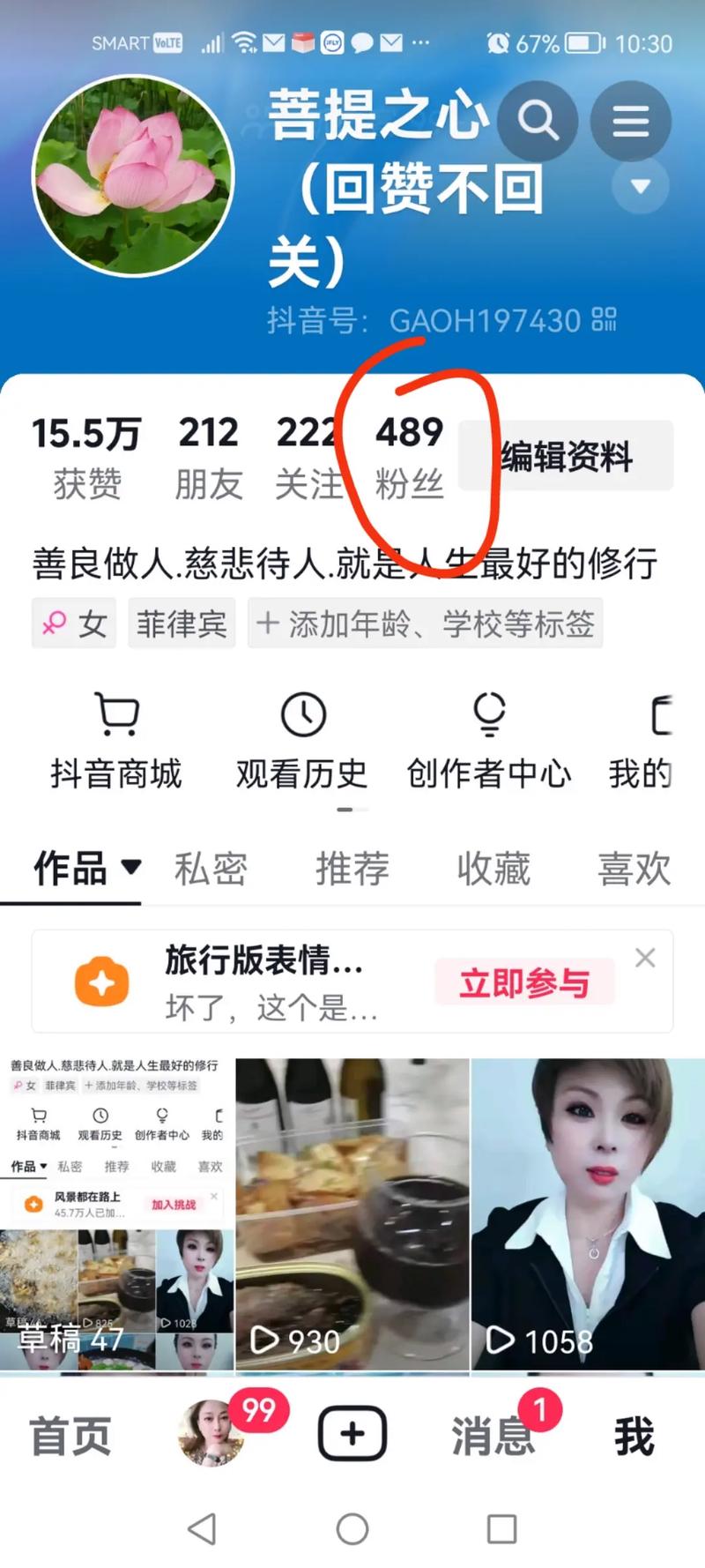 一、抖音为什么会出现僵尸粉?