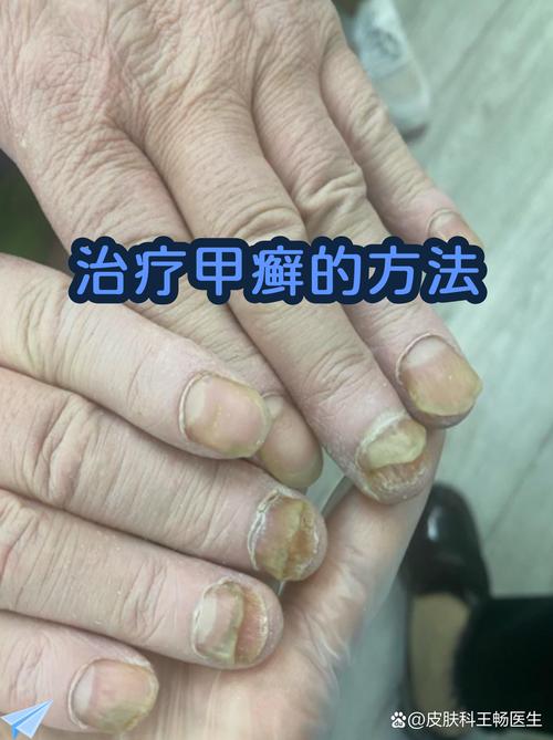 如何在疫情中有效应对与恢复