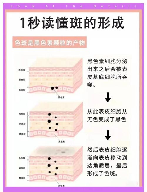 电脑辐射斑，你在这里见过吗？