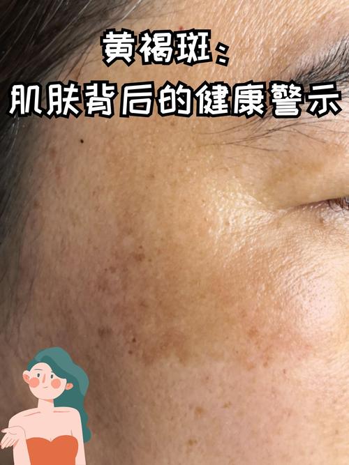 电脑辐射斑,你可能不知道的健康问题