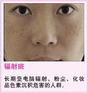 论电脑辐射斑,你的健康问题?你的解决方案?